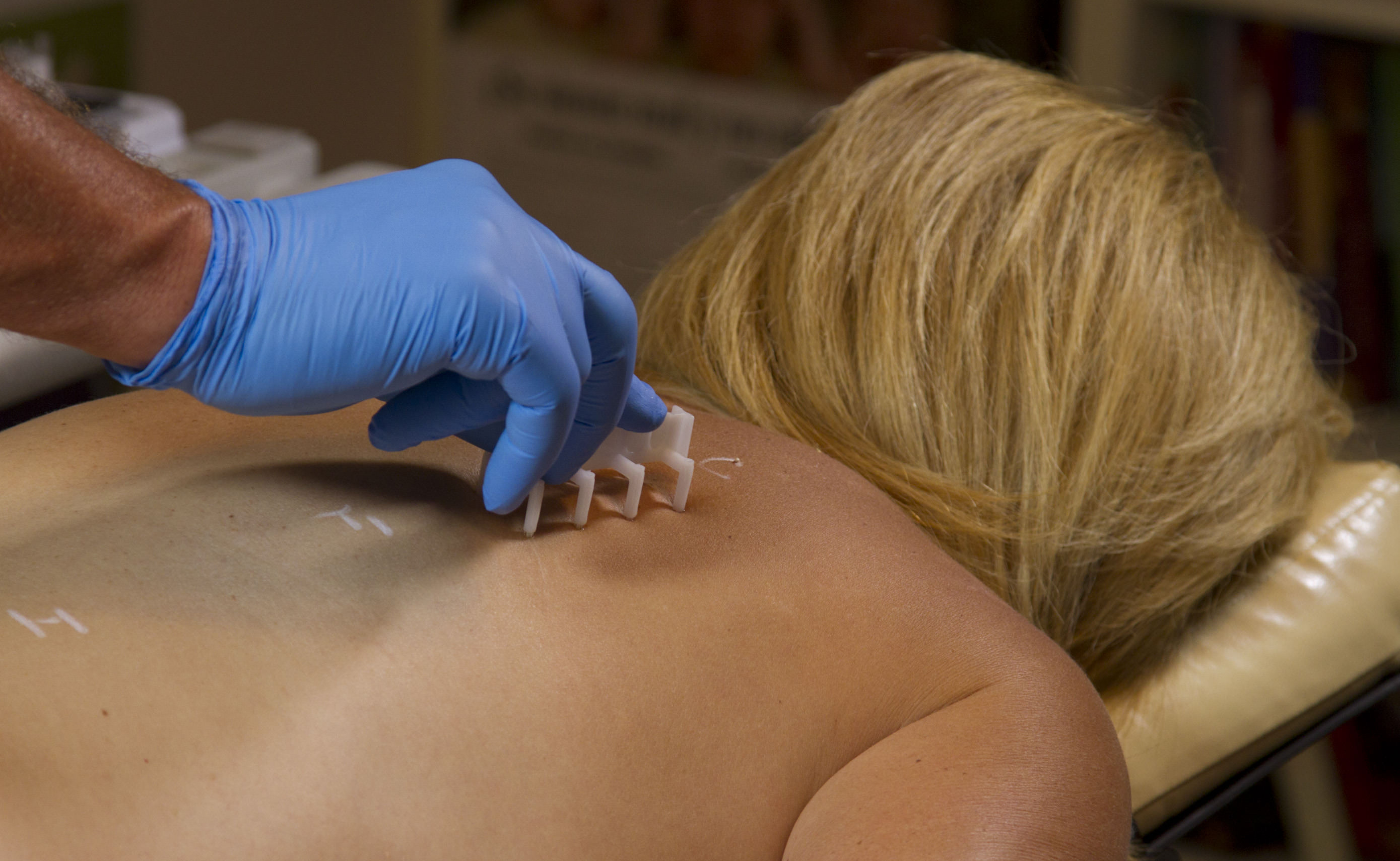 skin-test-with-8_prong-10