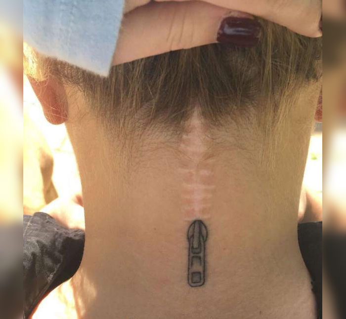 06-Tattoos-That-Transform-Scars