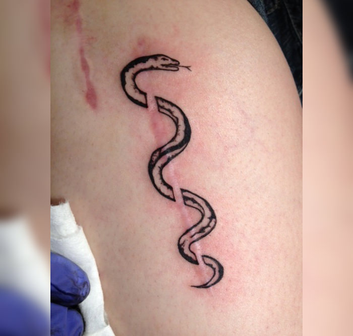 08-Tattoos-That-Transform-Scars