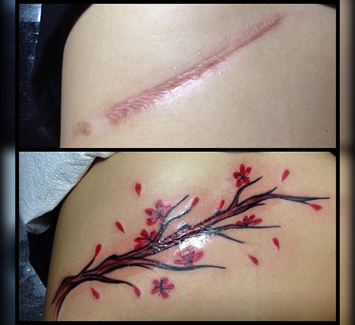 12-Tattoos-That-Transform-Scars