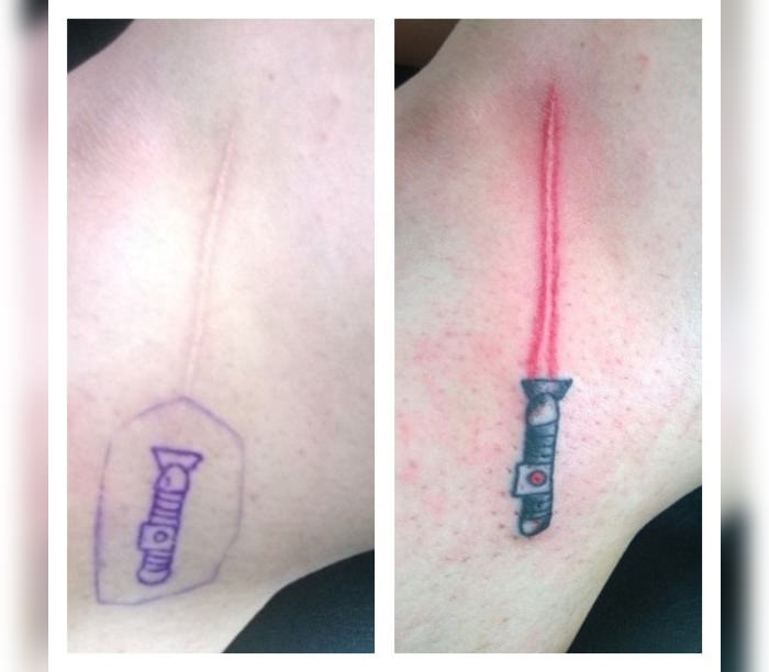 13-Tattoos-That-Transform-Scars