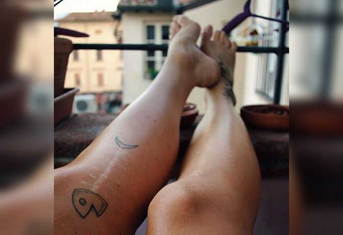 15-Tattoos-That-Transform-Scars