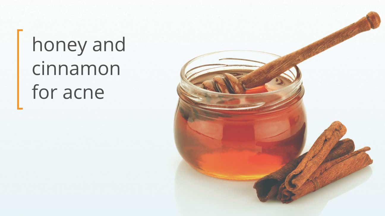 1296x728_HEADER_Using_Honey_and_Cinnamon_for_acne